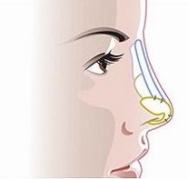 情人节“*力暴**亲热”！做过隆鼻后会被撞歪？