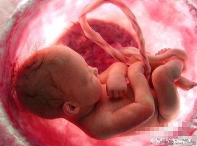 胎儿在肚子里面吃喝拉撒咋办,胎儿粪便进入羊水里是什么原因