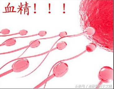 精子带血需要治疗吗,精子带血严重吗