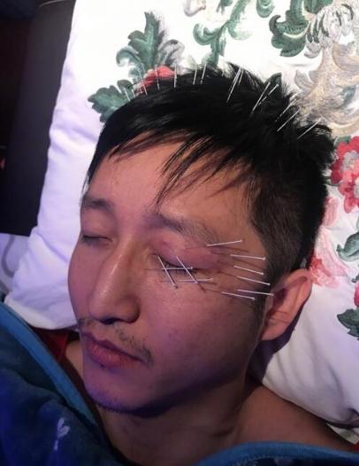 邹市明眼睛恢复视频,拳王邹市明眼睛受伤视频