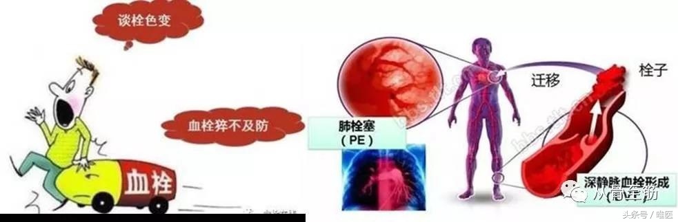 小血栓如何治疗,提前发现血栓小妙招