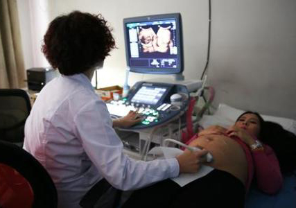 胎儿b超拍照,孕期b超留念