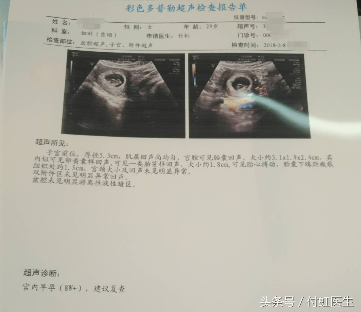 早孕期出血先兆流产吃什么药,先兆流产孕酮5.12保胎成功率高吗