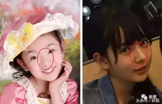 吴奇隆新剧搭档的女主13岁开始整形之路，这脸霹雳虎都hold不住！