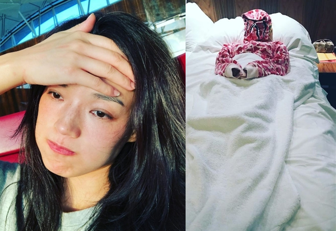 舒淇过敏都用什么护肤品呢,紫外线过敏舒淇