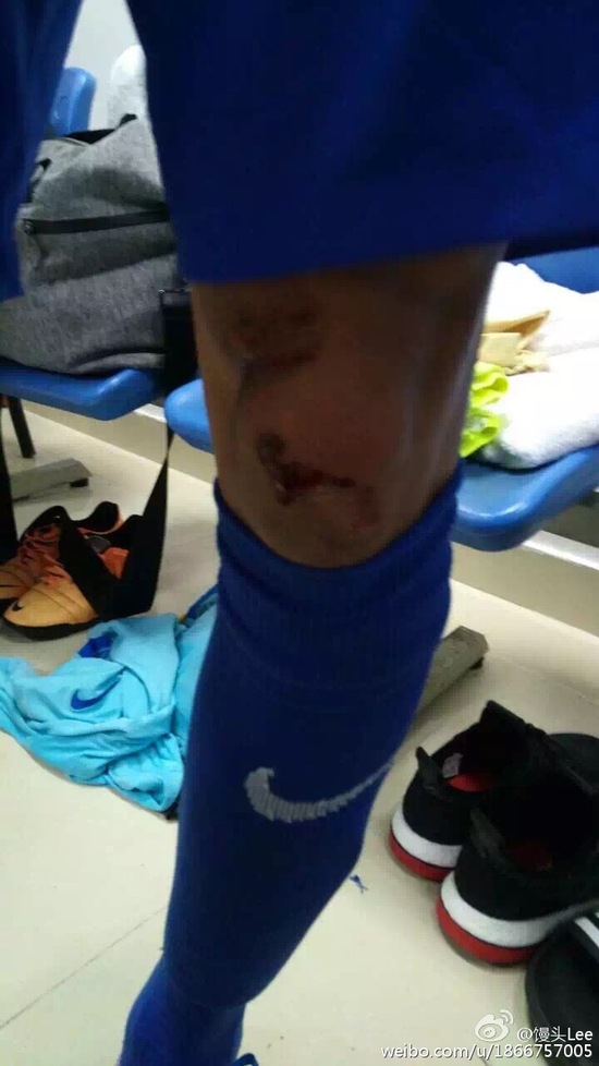 苏宁足球被打,江苏苏宁球员和对方发生冲突