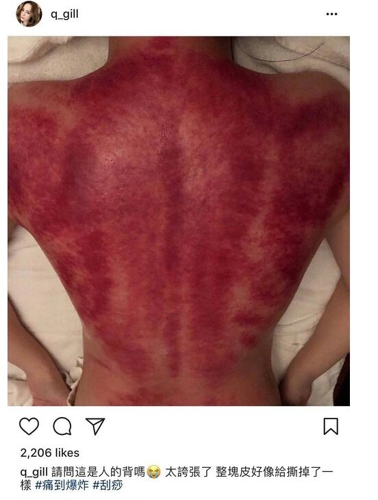 阿娇年轻时的腿粗吗,阿娇有多矮