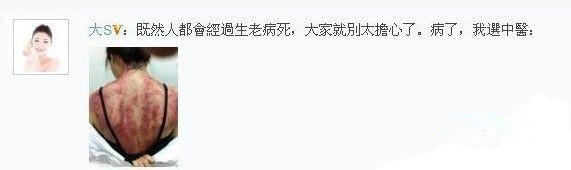 阿娇年轻时的腿粗吗,阿娇有多矮