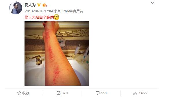 阿娇年轻时的腿粗吗,阿娇有多矮