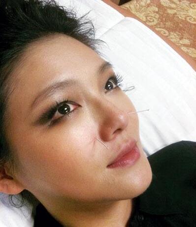 阿娇年轻时的腿粗吗,阿娇有多矮