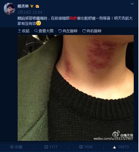 阿娇年轻时的腿粗吗,阿娇有多矮