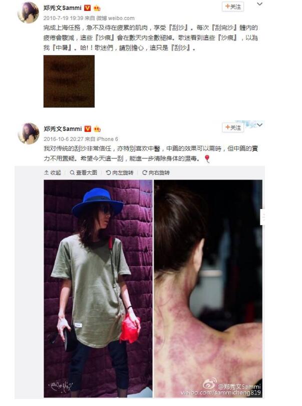 阿娇年轻时的腿粗吗,阿娇有多矮