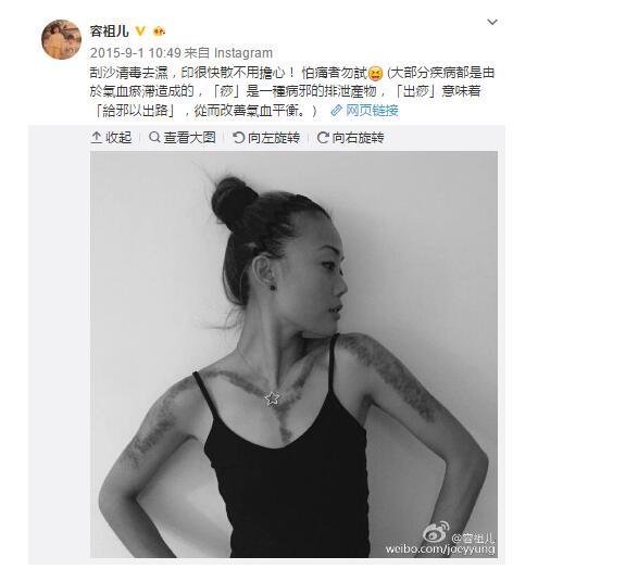 阿娇年轻时的腿粗吗,阿娇有多矮