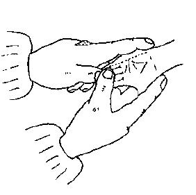 宝宝面黄是由什么原因引起的,儿童面色萎黄消瘦无血色