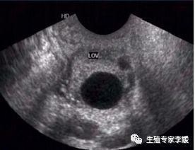 刚生育的女性要关注什么,有生育要求的女性