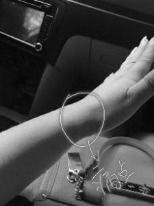 腕管综合征孕妇有多疼,腕管综合征孕妇最易患