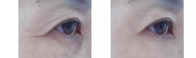 如何判断自己的眼睛的年龄,听说从一个人的眼睛可以看出年龄