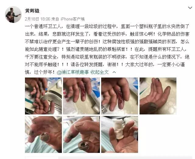 环卫工除夕夜捡垃圾被强酸腐蚀手指，网友：看着都疼的心里发毛