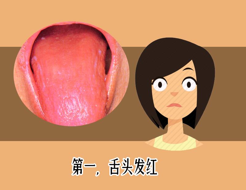 舌苔发黑辨证,舌苔整体发黄警惕四种原因