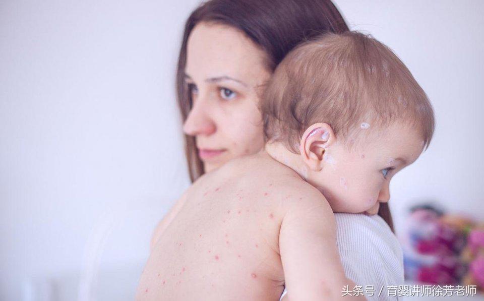 一喝完奶粉脸就泛红,喝奶粉后脸发红