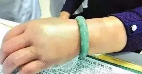 翡翠手镯拿不下来了怎么办,翡翠手镯弄不下来