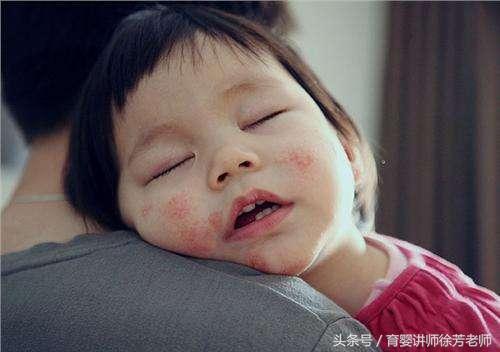 一喝完奶粉脸就泛红,喝奶粉后脸发红