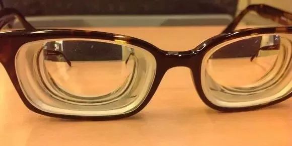 激光近视手术真的靠谱吗,激光近视手术靠谱吗