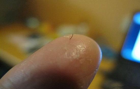 头发能扎到肉里面吗,头发怎么扎到肉里的