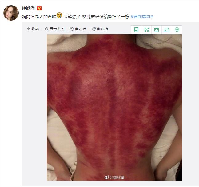 阿娇清晨发裸背照，网友：我的内心毫无波动，甚至有点恶心