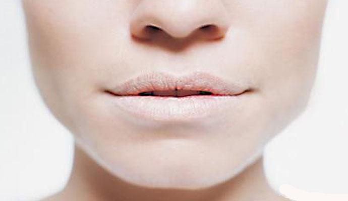 健康嘴唇颜色跟不正常区别,看看你的唇色是否健康