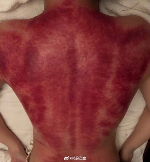 阿娇清晨发裸背照，网友：我的内心毫无波动，甚至有点恶心