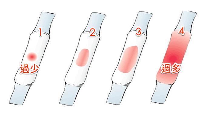 大姨妈迟到、早到、过多、过少，可能预示了这些疾病
