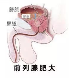 中医泌尿系统疑难杂症,尿路方面的名医