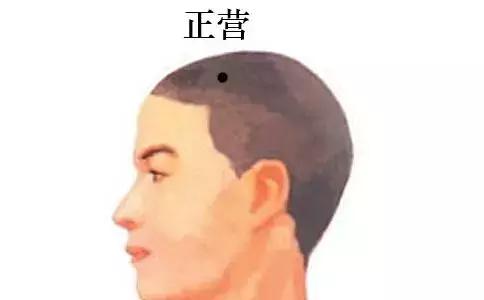 小儿黄疸十六点怎么治,小儿黄疸的原因中医