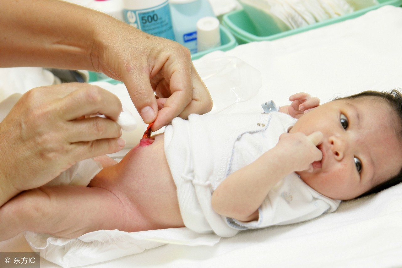 新生儿常见6大问题关注事项,新生儿满百天有什么禁忌