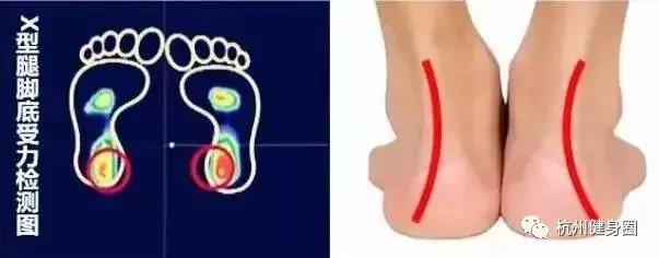 如何挑选一双适合自己的跑鞋,跑步脚掌疼适合选什么跑鞋