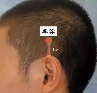 小儿黄疸十六点怎么治,小儿黄疸的原因中医