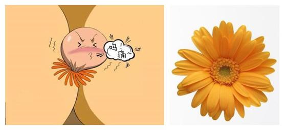 痔疮便血喷射怎么办,痔疮胀得很咋办