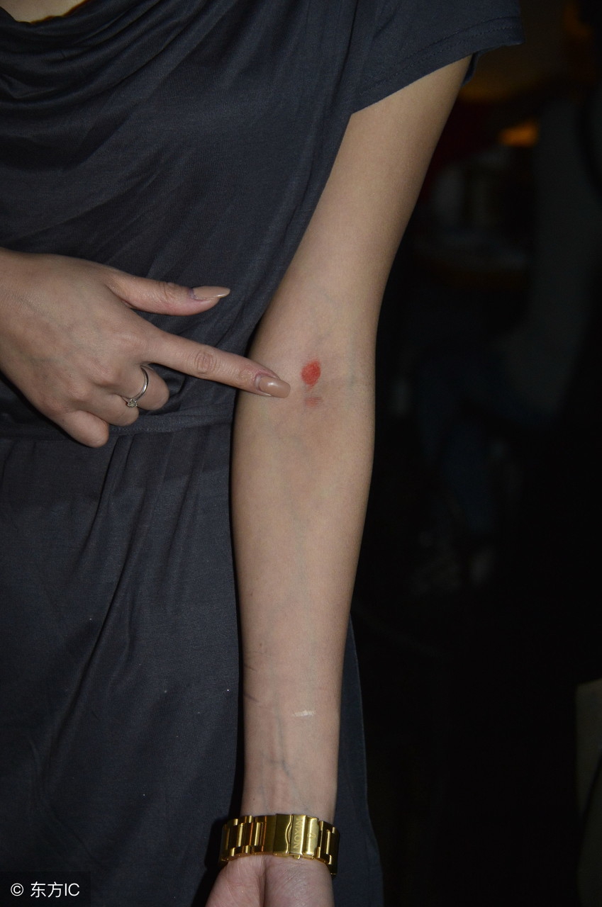 你的车上也贴着壁虎吗？