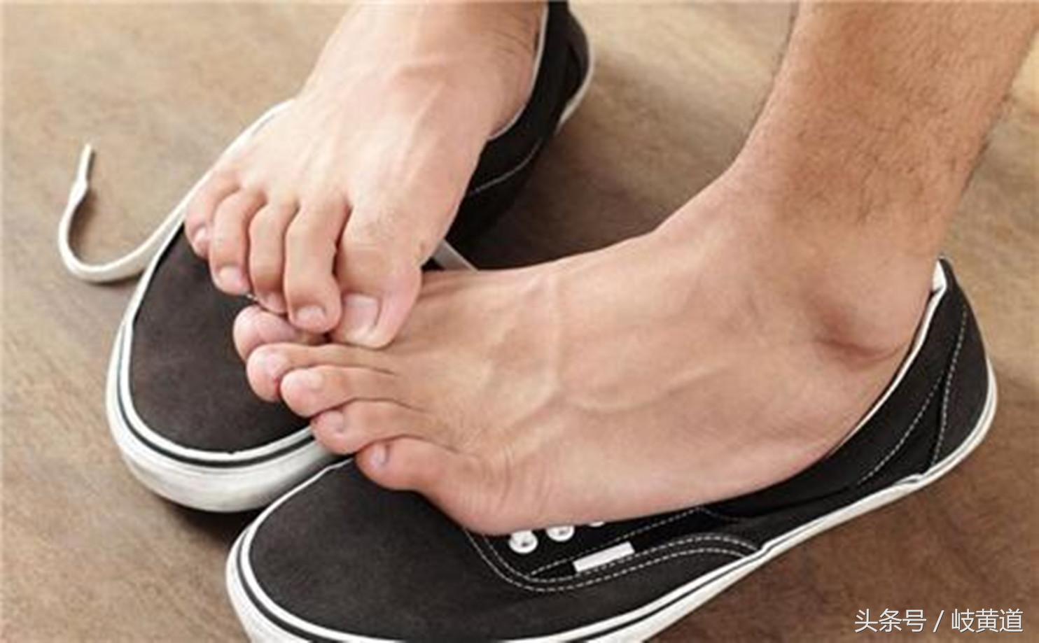 脚臭是不是得了脚气啊,脚臭和脚气有关联吗