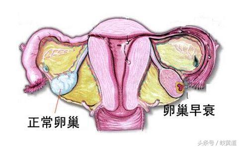 当出现月经推后、心烦易怒、周身乏力等症状要警惕1种妇科病
