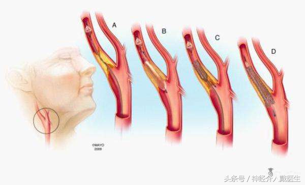 经常晕倒什么原因,经常晕倒是什么原因