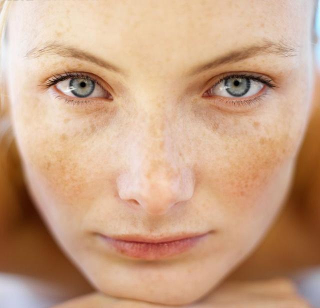只需学会这几招，多年的色斑都消失了，只可惜没什么人会用