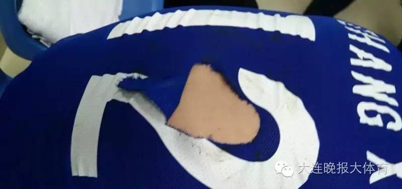 足协杯苏宁遭业余球队罕见*攻围**，武汉宏兴表示打人者一律开除！