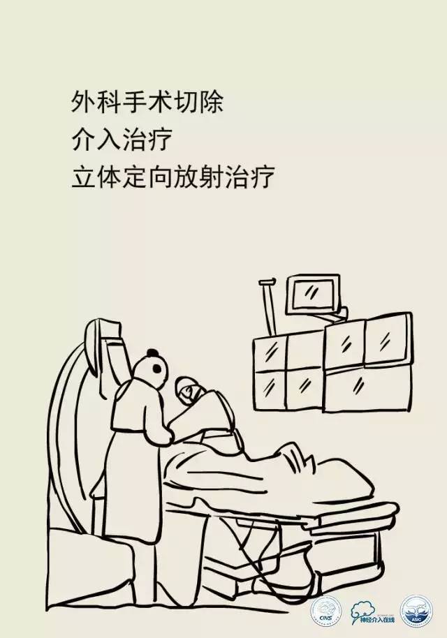 熊猫医生阿缪：脑动静脉畸形怎么破