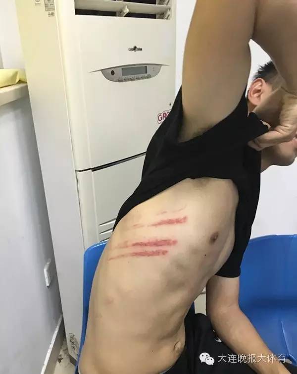 足协杯苏宁遭业余球队罕见*攻围**，武汉宏兴表示打人者一律开除！