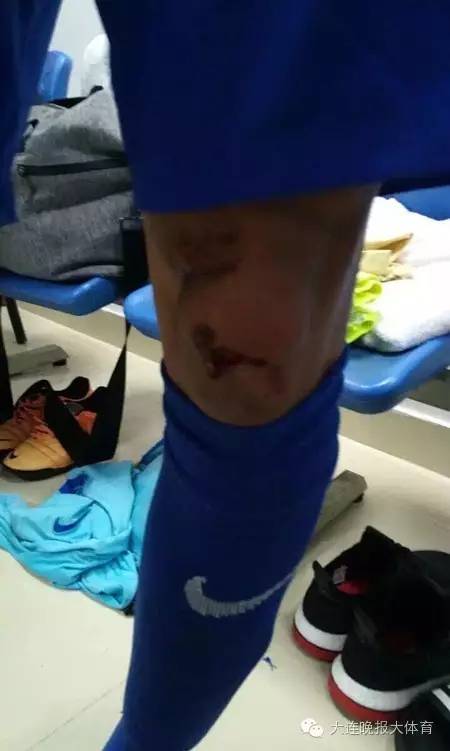 足协杯苏宁遭业余球队罕见*攻围**，武汉宏兴表示打人者一律开除！