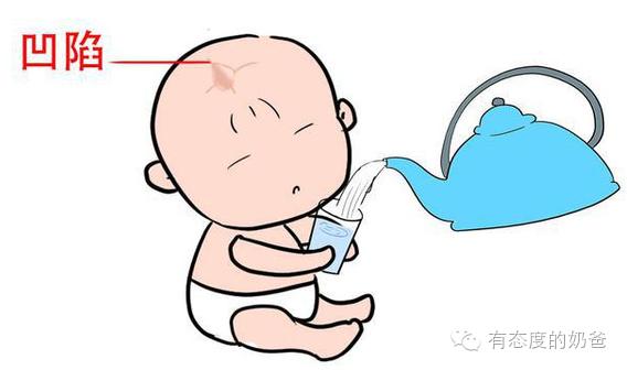 怎么保护好婴儿囟门,如何呵护宝宝囟门