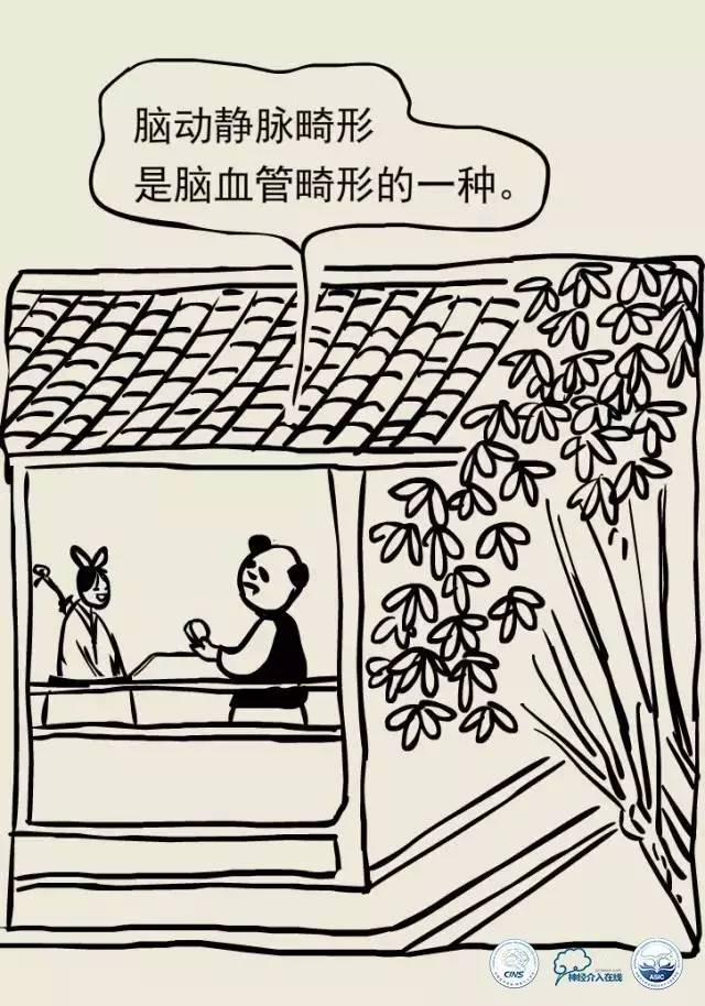 熊猫医生阿缪：脑动静脉畸形怎么破