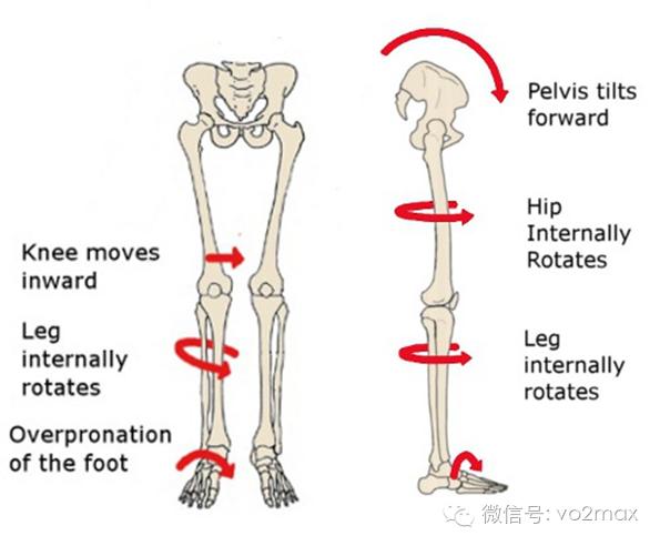 扁平足的危害与运动康复,扁平足对短跑运动的危害